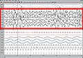 Électro-encéphalogramme du sommeil