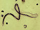 Nématodes (ici Wuchereria bancrofti)